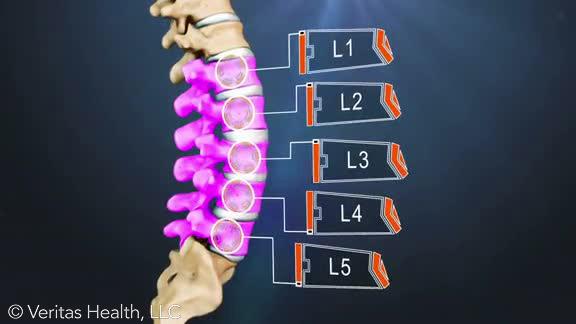 lumbar-spinal-discs-l1-l2-l3-l4-l5_veritas-health